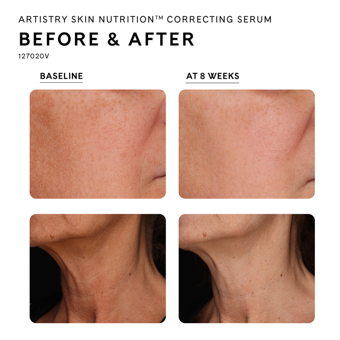 Artistry Skin Nutrition™ Correcting Serum